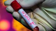 Se detectó H3N2 en el país