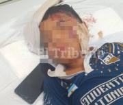 VIDEO. Atropellaron a un nene, el auto huyó y los vecinos de barrio Libertad exigen respuestas