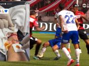 Matías Pellegrini mostró cómo quedó su pierna tras el planchazo que sufrió en el partido contra Instituto y bromeó con los puntos de sutura: 3+2=5