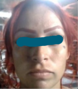 Dictan condena contra venezolana herida por el ICE: la jueza le prohíbe acercarse a zonas de prostitución