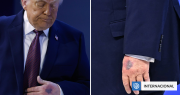 Donald Trump vuelve a generar preocupación por su salud al evidenciar morentones en sus manos