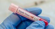 OMS considera bajo el riesgo de expansión del letal virus Nipah ante alerta mundial