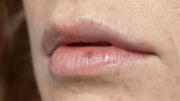 Cáncer labial: Cómo prevenirlo, señales de alerta y lo que no se debería pasar por alto