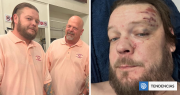 Corey Harrison de El precio de la historia sufre grave accidente en moto: tiene 11 fracturas