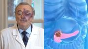 Gran hallazgo: una triple terapia abre una nueva esperanza frente al cáncer de páncreas