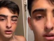 Salvaje ataque en patota de un grupo de rugbiers a un joven de 19 años a la salida de un boliche en Tucumán: No me puedo mover