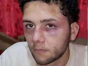 Un hombre denunció que sus jefes lo amenazaron y golpearon para que renuncie