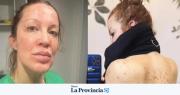 “Me debilitó”: Miriam Lanzoni visibilizó el impacto de la psoriasis en su vida