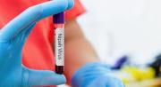 ¿Qué es el virus Nipah y por qué mantiene en alerta al mundo entero?