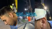 Violento ataque a un chofer de micro en La Plata: le arrojaron una piedra en la cabeza mientras llevaba pasajeros