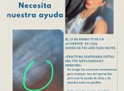 Josbelys requiere apoyo económico urgente tras sufrir una fractura de metatarsiano