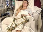 Lindsey Vonn y una impactante imagen tras su lesión en los Juegos Olímpicos de Invierno: ya la operaron tres veces por la fractura en la pierna