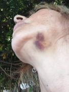 La arrastraron de los pelos en medio de un feroz robo