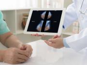 La mayoría de los cánceres evitables están ligados a solo dos hábitos: cuáles son y cómo reducir el riesgo