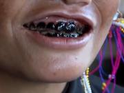 Dientes negros: qué significa este ritual de belleza de 2.000 años de antigüedad