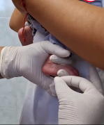 Prueba del Talón todos los martes y jueves en el Seguro