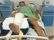 Aníbal Gamón sufre grave accidente y necesita ayuda