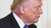 Trump sufre un gran sarpullido en su cuello en medio de tensión mundial: esto dijo su médico