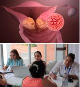 Entre 70 y 80 mujeres fallecen al año por cáncer cervicouterino