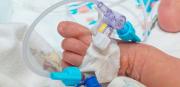 Bebé prematura necesita con urgencia un catéter