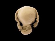 Ya está online y gratuito el Google Earth de los órganos humanos