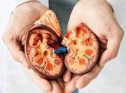 Los 9 alimentos que aumentan el riesgo de piedras en los riñones y cómo reemplazarlos