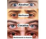 Monitorear la situación