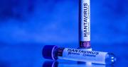 El paciente español que dio positivo por hantavirus presenta síntomas