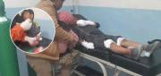 NIÑO SUFRE GRAVES LESIONES TRAS PRESUNTA EXPLOSIÓN DE PETARDO EN EL ALTO
