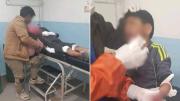 Un niño resulta herido por explosión de petardo durante bloqueos en El Alto