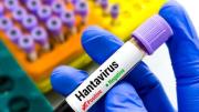 La mortalidad por hantavirus entre adolescentes alcanza el 50 %, revela nueva investigación