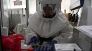 Falta de especialistas, registros y laboratorios: el diagnóstico crítico de la toxicología en Bolivia