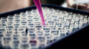 Nuevo tratamiento para cáncer de páncreas reduce 60% el riesgo de muerte y abre una nueva esperanza