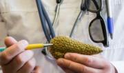 Una fármaco innovador logra duplicar el tiempo de supervivencia en pacientes con cáncer de páncreas