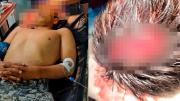 Confirman disparo en la cabeza a un policía en San Julián; ingresó a terapia intensiva