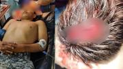 Confirman disparo en la cabeza a un policía en San Julián; ingresó a terapia intensiva