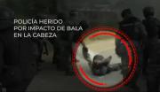 Policía herido por un proyectil en la cabeza presenta una evolución favorable en Santa Cruz