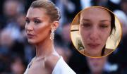 Bella Hadid atraviesa nueva recaída por la enfermedad de Lyme: “Nada ayuda todavía”