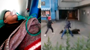 El policía agredido durante los conflictos todavía lucha por recuperar la visibilidad y se va a Argentina