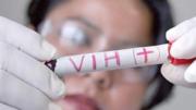 Alistan acciones preventivas contra el VIH por Urcupiña; Cochabamba registra entre 1 y 2 casos nuevos cada día
