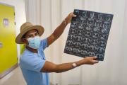 Vivió 14 años con un tumor en el rostro: médicos de Montero se lo extirpan con la primera cirugía planificada en 3D