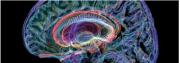 Neuroestética:  donde la belleza se encuentra con el cerebro