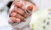 Madre embarazada fue aprehendida tras quemar a su hija de nueve años con agua caliente