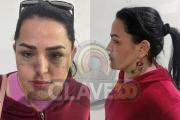 “Angeliquinha”, condenada a 260 años en Brasil, es capturada en Santa Cruz cuando acudía a una curación tras cirugía facial