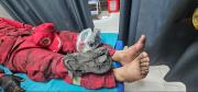 Cochabamba: dos bomberos siguen internados con quemaduras y crece la preocupación por otros incendios